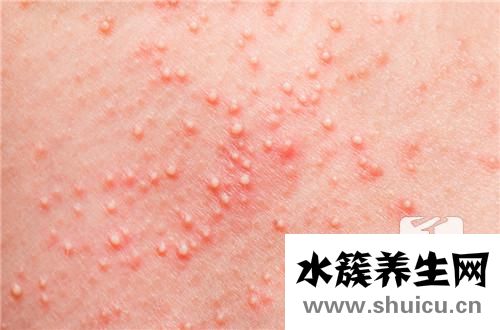 額頭上長小米粒疙瘩