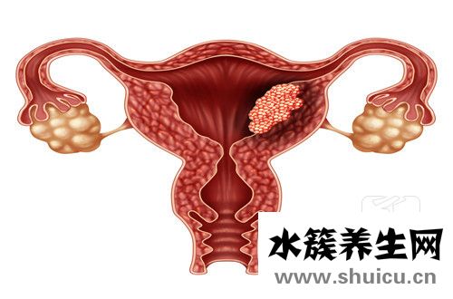 殘角子宮