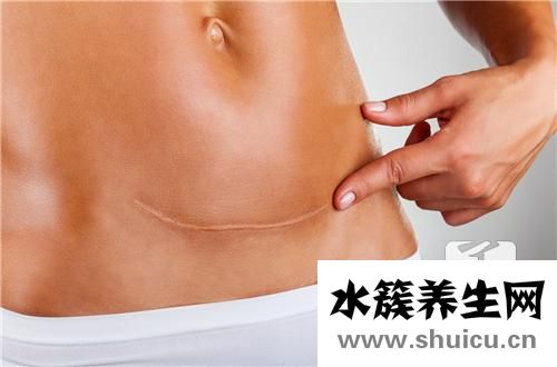 卵巢囊腫是怎么引起的