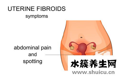 宮頸腺囊腫