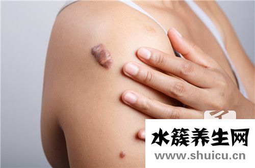 皮下長疙瘩