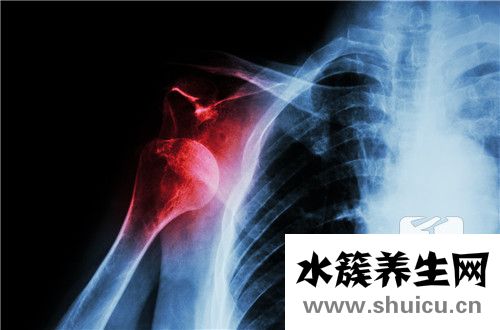盂唇損傷