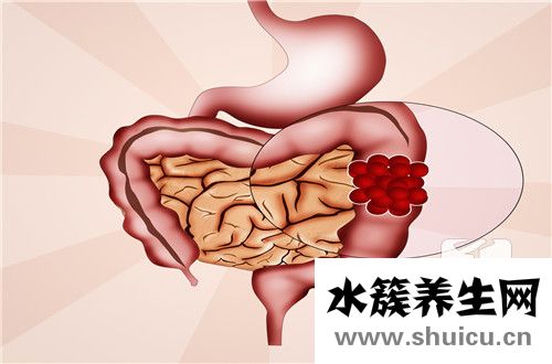 低級別上皮內瘤變