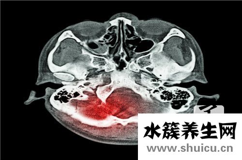 顱前窩