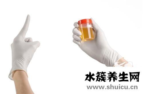 尿沉渣檢查