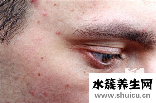 維生素b6軟膏