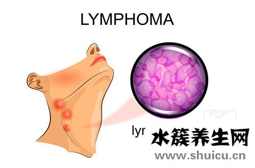 淋巴結腫