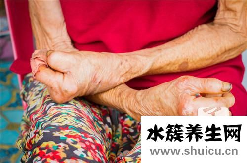 麻風桿菌