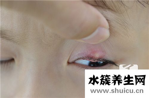 裂隙燈檢查什么