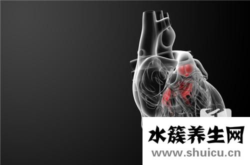 主動脈瓣鈣化