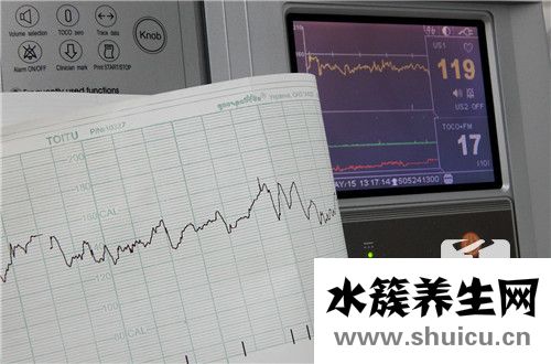 雙硫侖反應