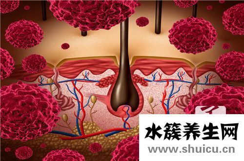 毛囊炎疙瘩怎么治療