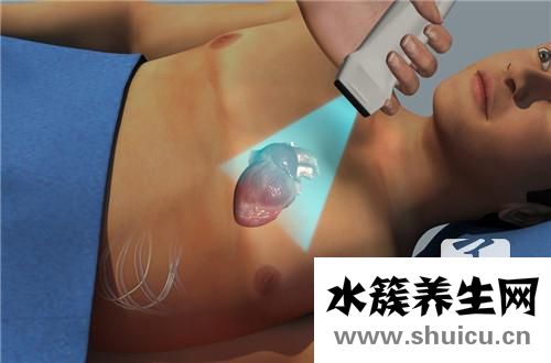 脈絡叢囊腫