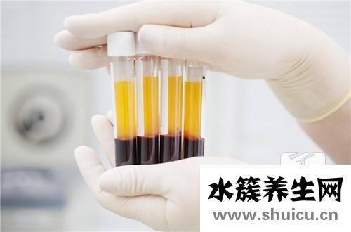 血清膽紅素