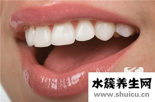 牙套的種類
