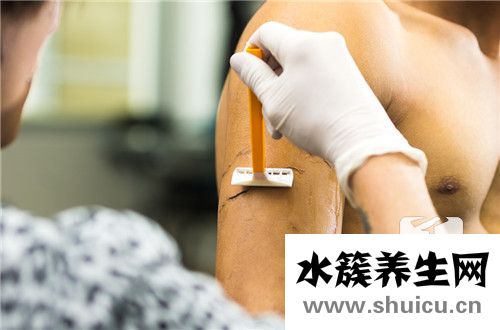 右手臂有痣