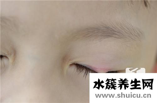 麥粒腫用什么眼藥水