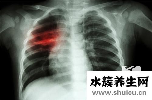 結核抗體