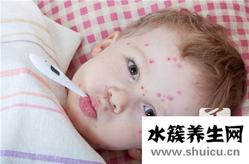水痘是怎么引起的