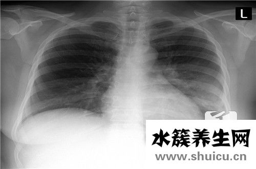 人體有多少塊骨頭