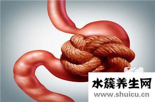 結腸多發憩室