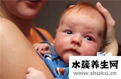 嬰兒臉上起小紅疙瘩