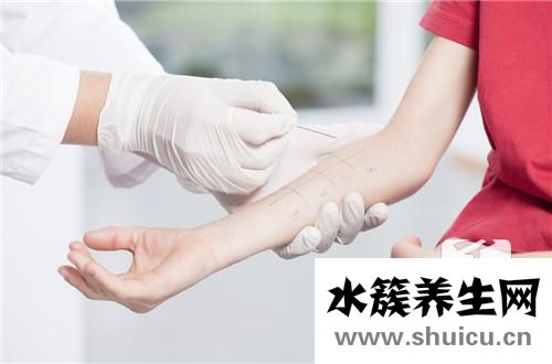 痤瘡怎樣治療