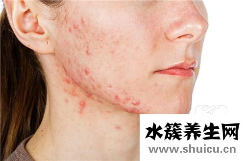 增效聯磺片