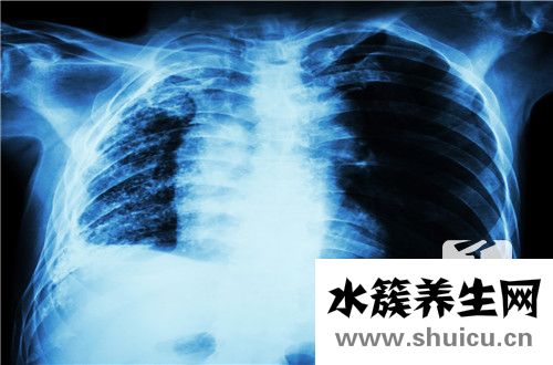 肺部纖維灶