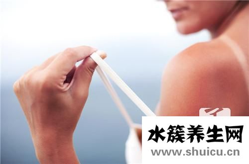 曬傷后如何修復