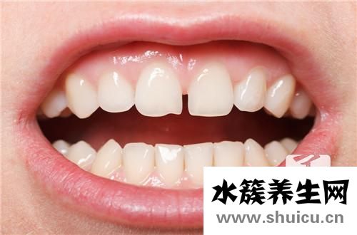 牙齒變白小竅門