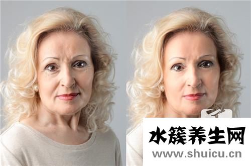 透明質酸除皺