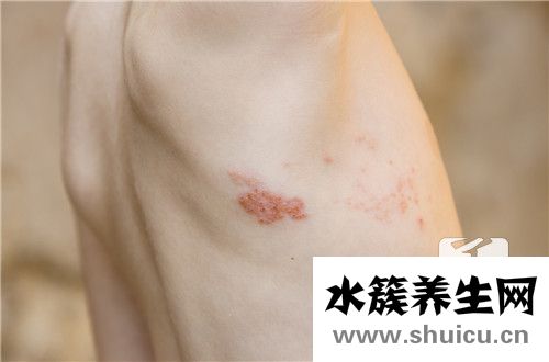 治療疼痛