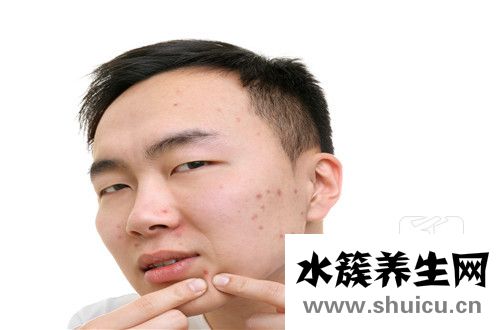 脂溢性痤瘡
