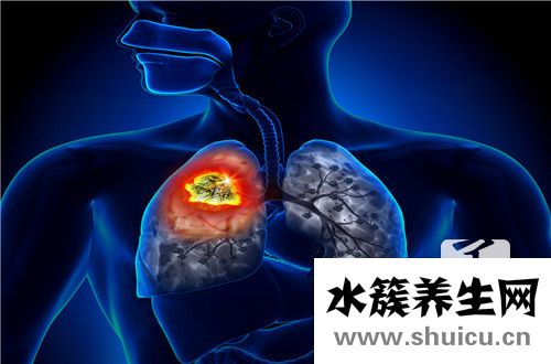 肺癌手術后