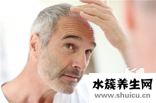 治療脂溢性脫發