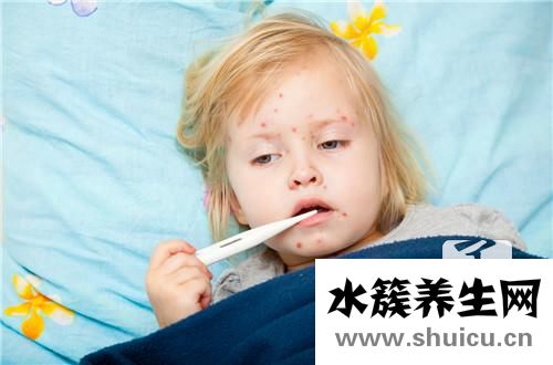 小兒蕁麻疹癥狀