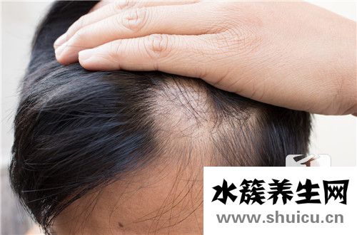 化療脫發