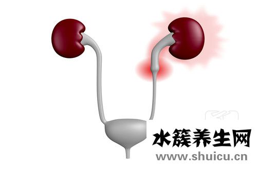 狼瘡腎