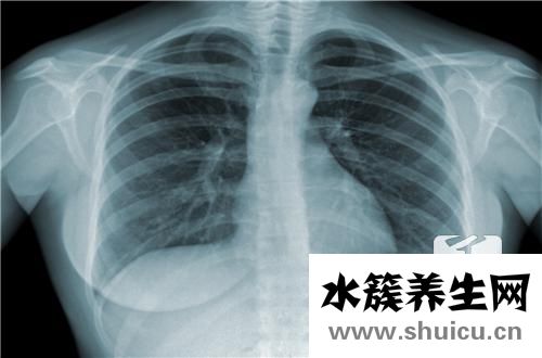 腦部磁共振