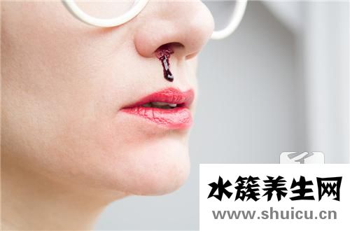 經常流鼻血的原因