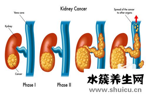腎上囊腫