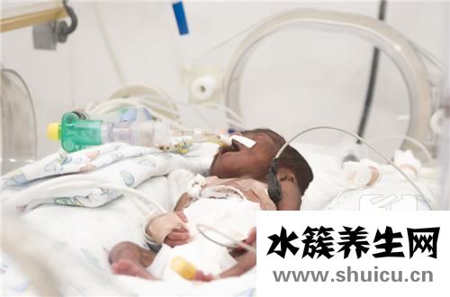 32周早產兒