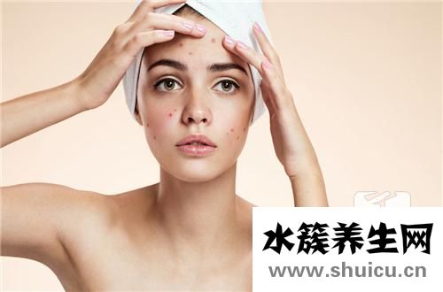 額頭上長痘痘怎么調理