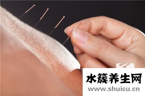 針刺療法