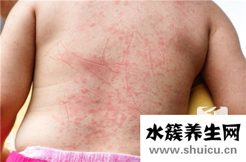 出血熱疫苗