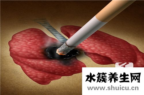 神經膠質瘤