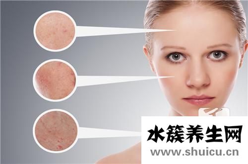 蛇盤瘡最佳治療方法