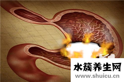 賁門炎