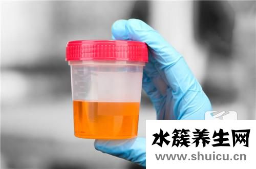尿酮體